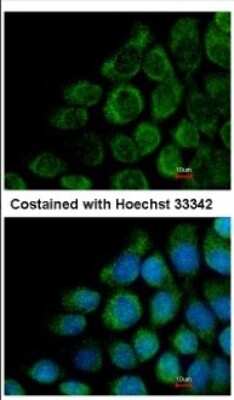Immunocytochemistry/ Immunofluorescence: COG8 Antibody [NBP2-15938]