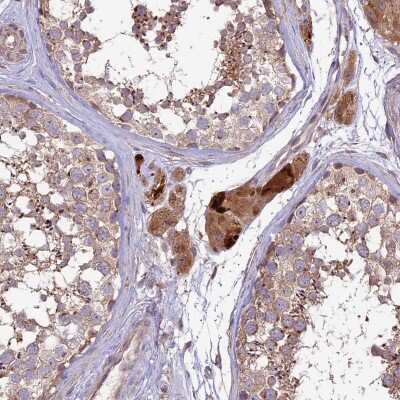 Immunohistochemistry-Paraffin: COG8 Antibody [NBP2-13853]