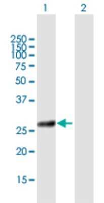 Western Blot: COG8 Antibody [H00084342-B01P]