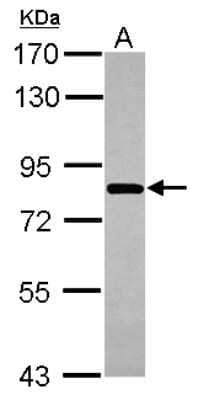 Western Blot: COG8 Antibody [NBP2-15938]