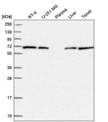 Western Blot: COG8 Antibody [NBP2-58437]