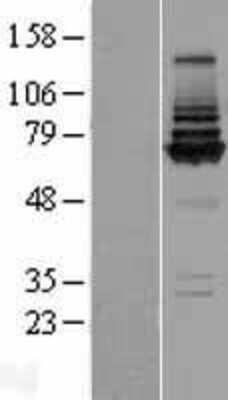 Western Blot: COG8 Overexpression Lysate [NBP2-06042]