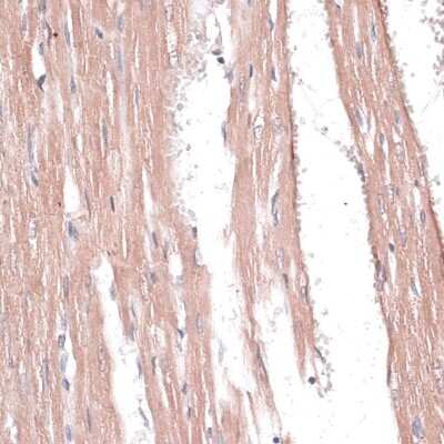 Immunohistochemistry-Paraffin: COL11A1 Antibody - BSA Free [NBP3-04904]