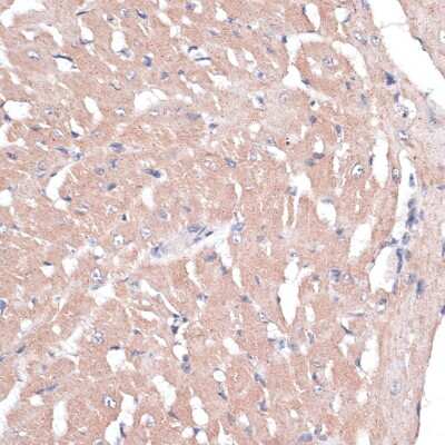 Immunohistochemistry-Paraffin: COL11A1 Antibody - BSA Free [NBP3-04904]
