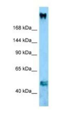 Western Blot: COL11A1 Antibody [NBP1-98463]