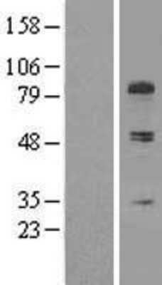 Western Blot: Collagen XIII alpha 1 Overexpression Lysate [NBL1-09349]