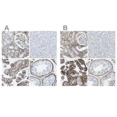 Immunohistochemistry-Paraffin: COL15A1 Antibody [NBP1-91087]