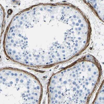 Immunohistochemistry-Paraffin: COL15A1 Antibody [NBP1-91087]