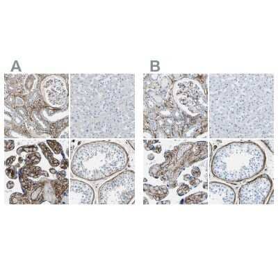 Immunohistochemistry-Paraffin: COL15A1 Antibody [NBP1-91088]