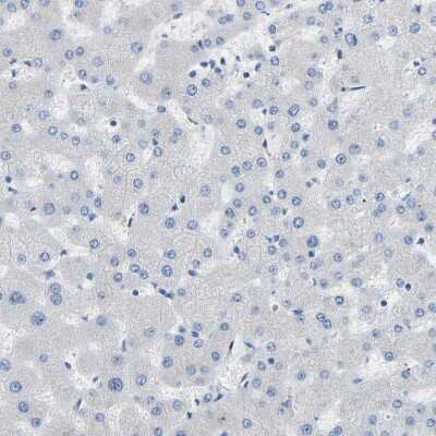 Immunohistochemistry-Paraffin: COL15A1 Antibody [NBP1-91088]