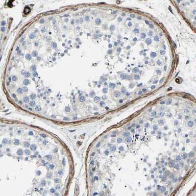 Immunohistochemistry-Paraffin: COL15A1 Antibody [NBP1-91088]