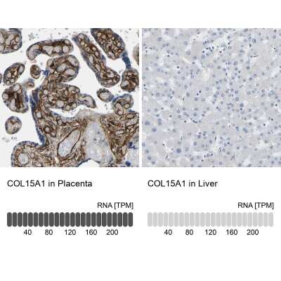 Immunohistochemistry-Paraffin: COL15A1 Antibody [NBP1-91088]