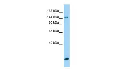 Western Blot: COL15A1 Antibody [NBP2-87202]