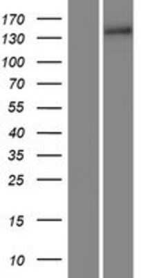 Western Blot: COL15A1 Overexpression Lysate [NBP2-08169]