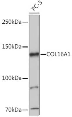 Western Blot: COL16A1 AntibodyAzide and BSA Free [NBP3-15605]