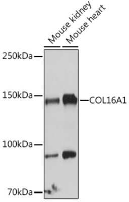 Western Blot: COL16A1 AntibodyAzide and BSA Free [NBP3-15605]