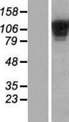 Western Blot: COL19A1 Overexpression Lysate [NBP2-08170]