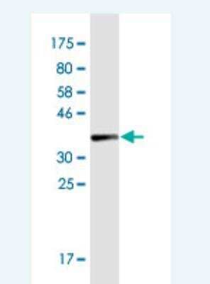 Western Blot: COL1A2 Antibody (7E11) [H00001278-M03]