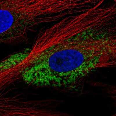 Immunocytochemistry/ Immunofluorescence: COL1A2 Antibody [NBP2-58529]