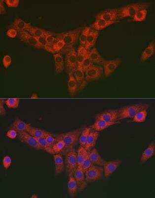 Immunocytochemistry/ Immunofluorescence: COL1A2 Antibody - Azide and BSA Free [NBP2-92790]