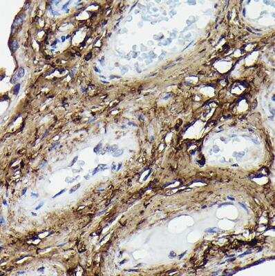 Immunohistochemistry-Paraffin: COL1A2 Antibody - Azide and BSA Free [NBP2-92790]