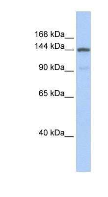 Western Blot: COL1A2 Antibody [NBP1-57987]