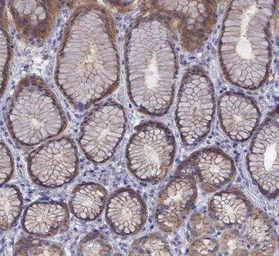 Immunohistochemistry-Paraffin: COL22A1 Antibody [NBP1-91056]