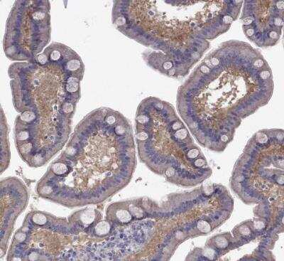 Immunohistochemistry-Paraffin: COL22A1 Antibody [NBP1-91056]