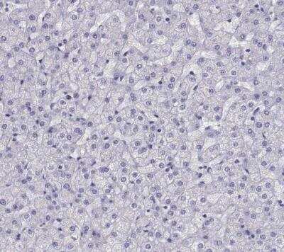 Immunohistochemistry-Paraffin: COL22A1 Antibody [NBP1-91056]