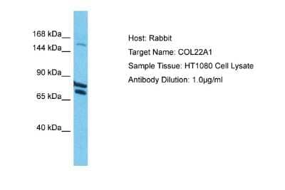 Western Blot: COL22A1 Antibody [NBP2-82730]