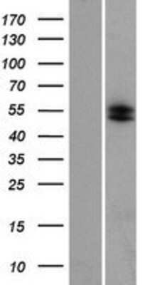 Western Blot: Collagen XXIII alpha 1 Overexpression Lysate [NBP2-05138]