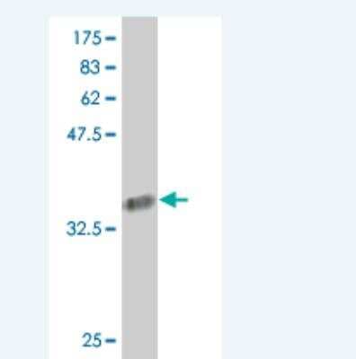 Western Blot: COL24A1 Antibody (1D8) [H00255631-M07]