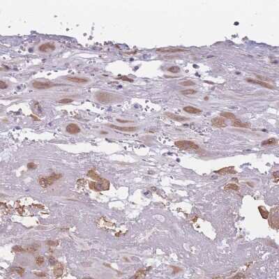 Immunohistochemistry-Paraffin: COL27A1 Antibody [NBP2-30615]