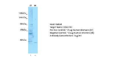 Western Blot: COL27A1 Antibody [NBP2-84711]