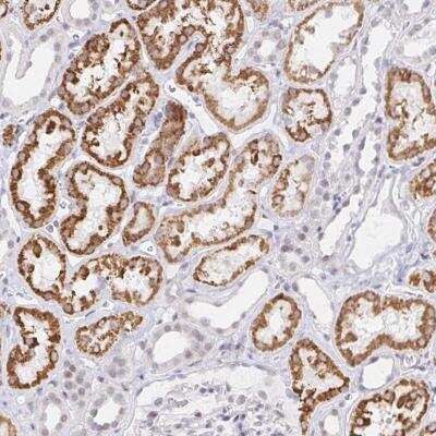 Immunohistochemistry-Paraffin: COL28A1 Antibody [NBP2-32547]