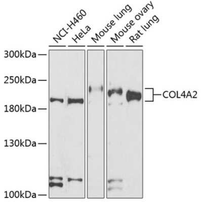 Western Blot: COL4A2 AntibodyBSA Free [NBP2-92506]