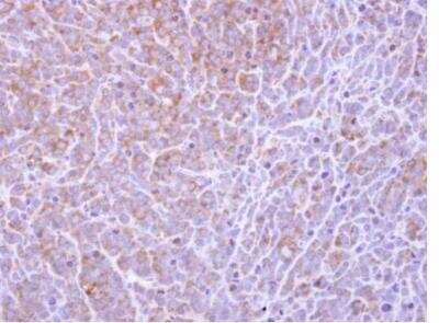 Immunohistochemistry-Paraffin: COL4A3BP Antibody [NBP1-31118]