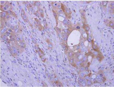Immunohistochemistry-Paraffin: COL4A3BP Antibody [NBP2-15942]