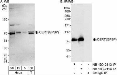 Western Blot: COL4A3BP Antibody [NB100-2114]