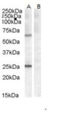 Western Blot: COL4A3BP Antibody [NB100-93386]