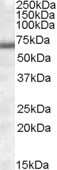 Western Blot: COL4A3BP Antibody [NBP1-06028]