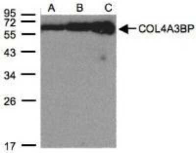 Western Blot: COL4A3BP Antibody [NBP1-31118]