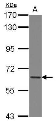 Western Blot: COL4A3BP Antibody [NBP2-15942]