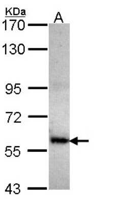 Western Blot: COL4A3BP Antibody [NBP2-15943]