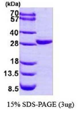 SDS-PAGE: Recombinant Human COL4A3BP His Protein [NBP1-44465]