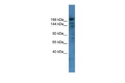 Western Blot: COL4A6 Antibody [NBP3-10658]