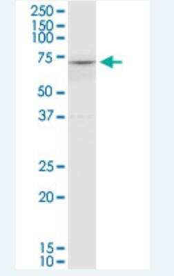 Western Blot: COL8A2 Antibody (1F4) [H00001296-M01-100ug]