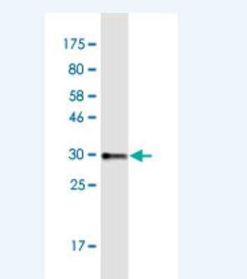 Western Blot: COL8A2 Antibody (1F4) [H00001296-M01-100ug]