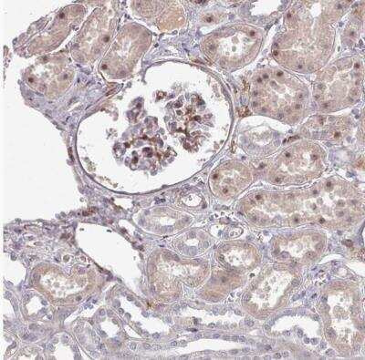 Immunohistochemistry-Paraffin: COL8A2 Antibody [NBP2-13857]