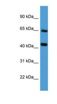 Western Blot: COL8A2 Antibody [NBP1-79787]